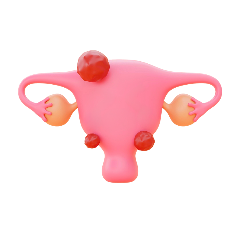 Tratamiento miomas y quistes ginecólogo Los Mochis